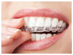 whitening photo14